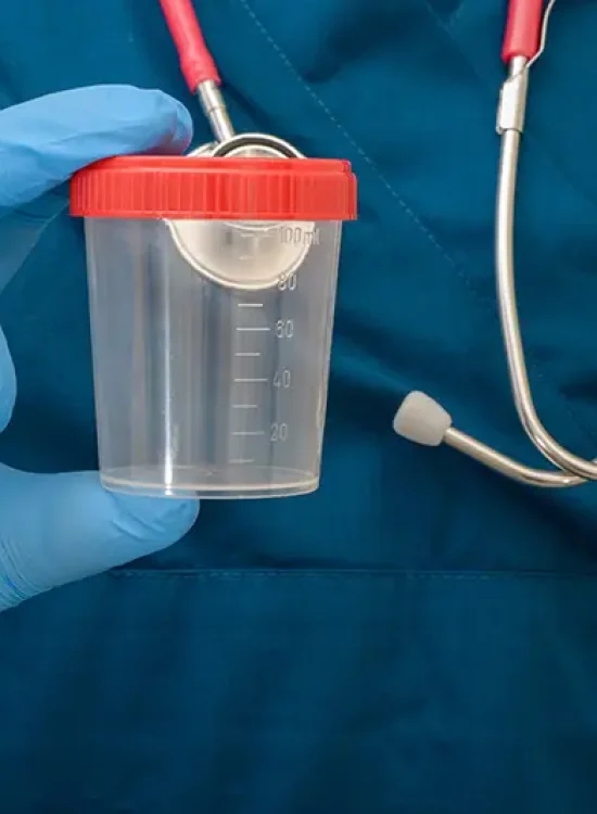 Medical professional holding a urine sample cup for drug testing, relevant to DUI/DWAI defense by Lori Beck Law Office in Denver.